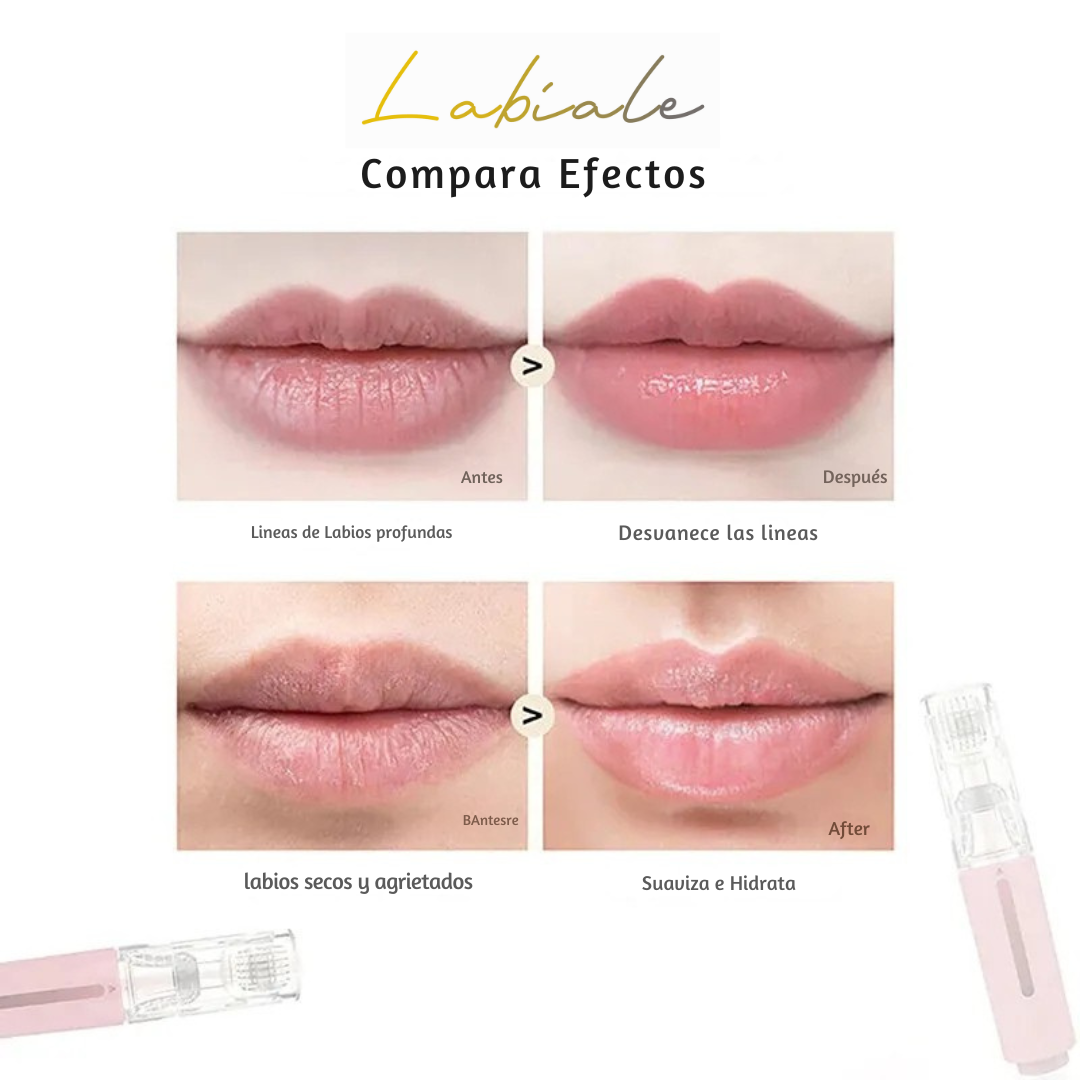Kit Potenciador de Labios