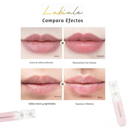 Kit Potenciador de Labios