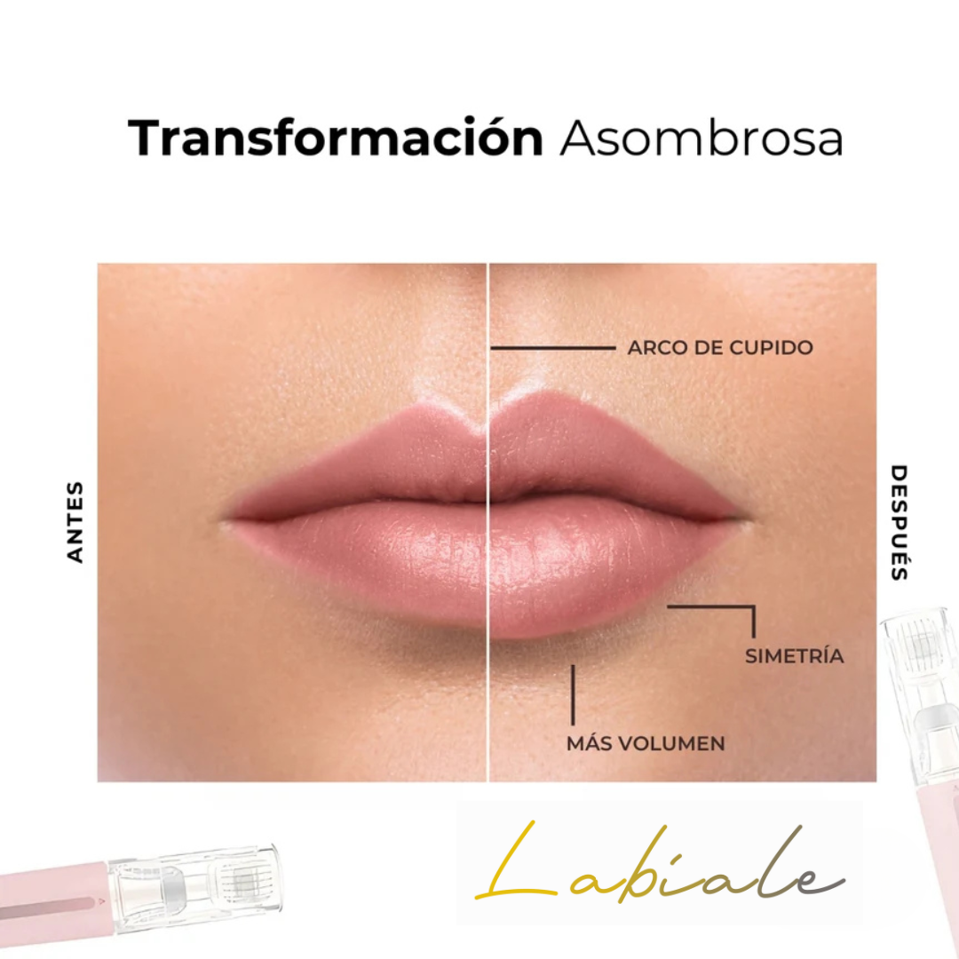 Kit Potenciador de Labios