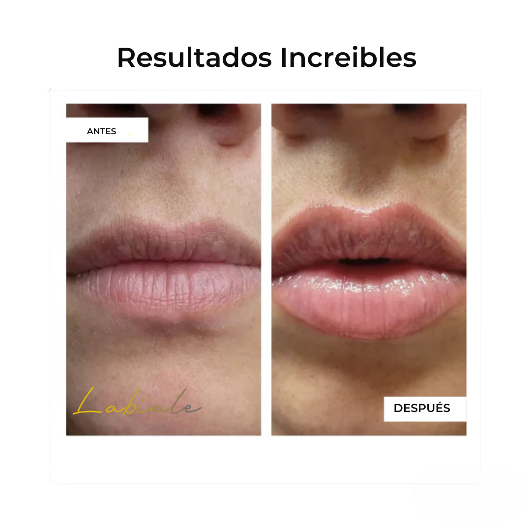 Kit Potenciador de Labios
